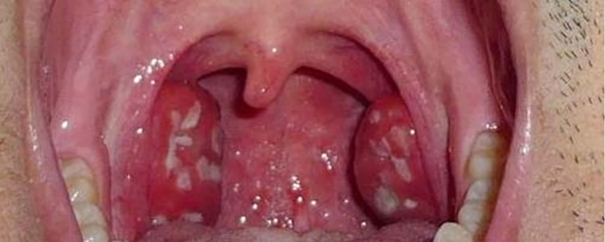 Doenças Respiratórias